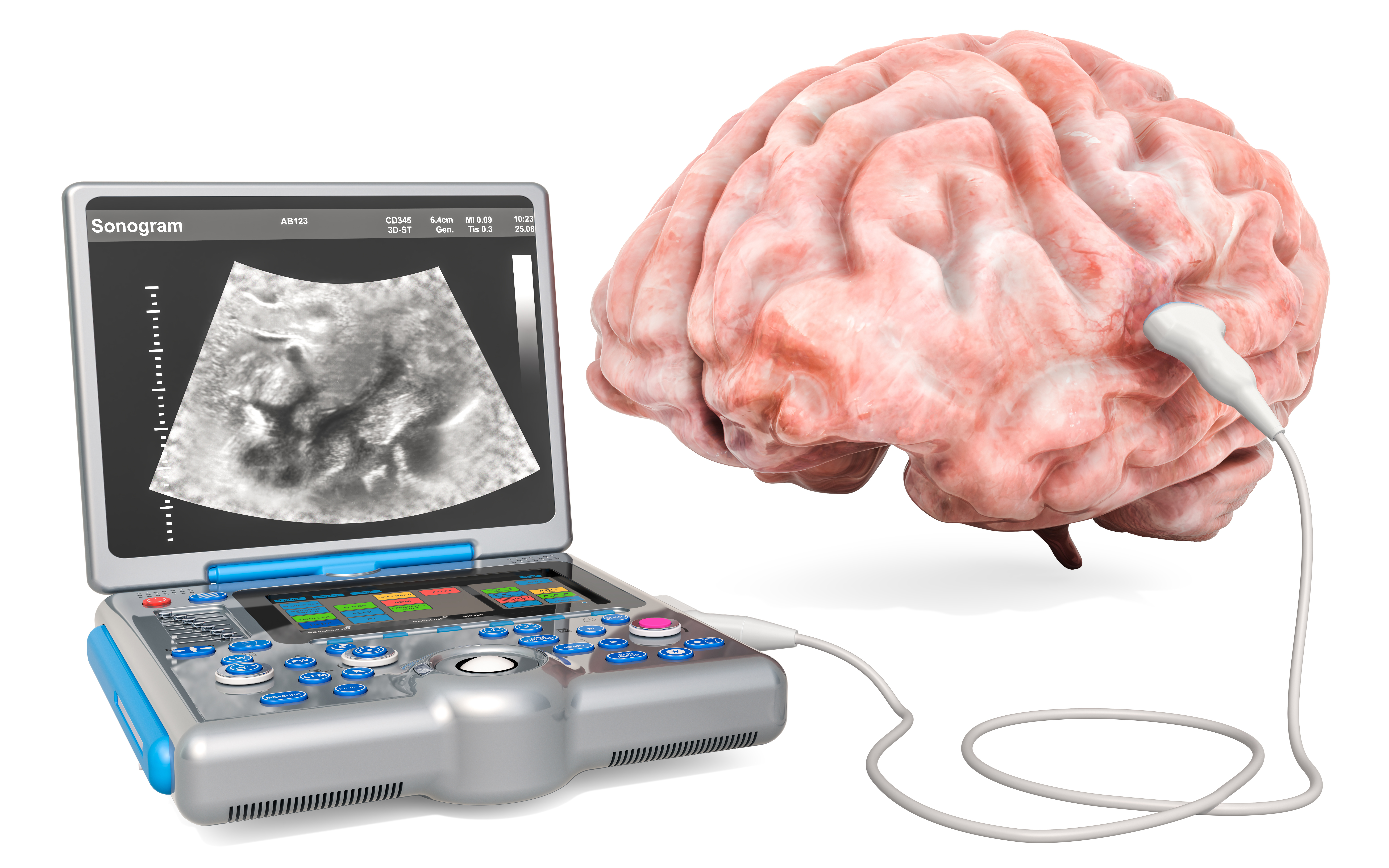 Ultrasound imaging and therapy for brain