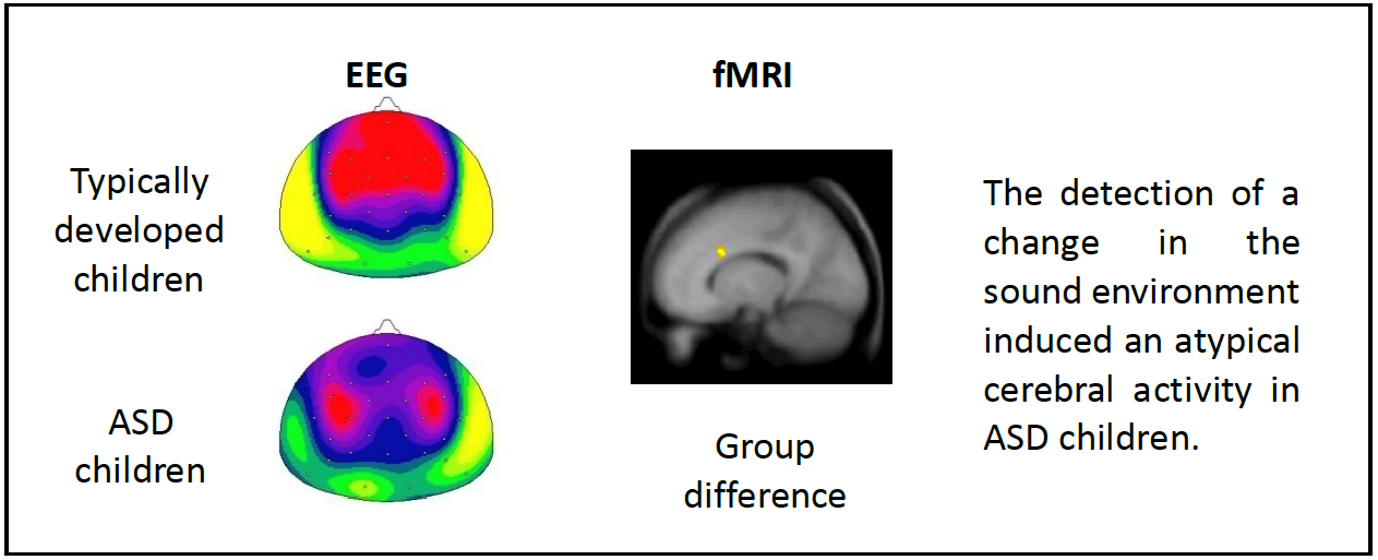 EEG