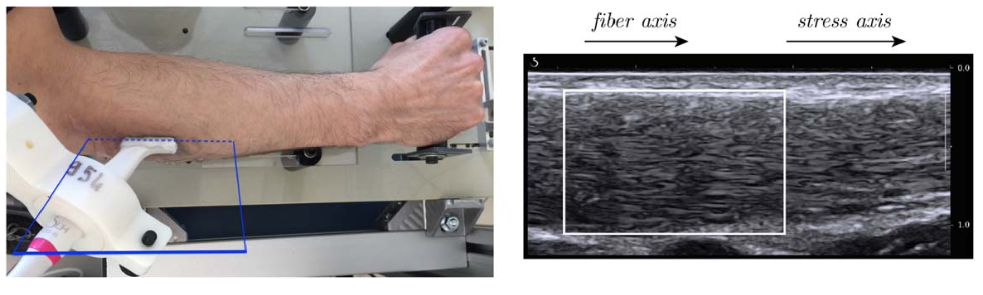 Ultrasound imaging of skeletal muscle