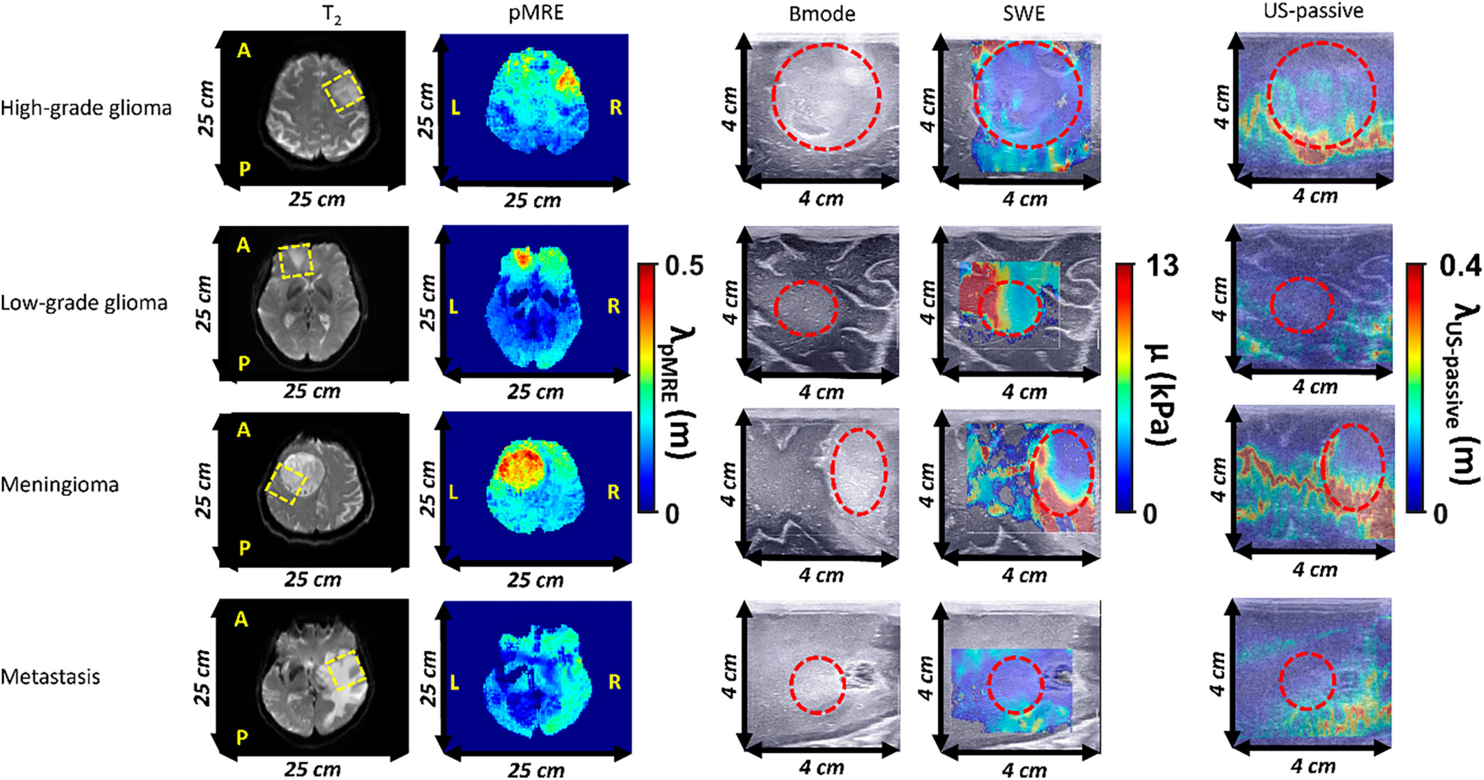 MR Passive Elastography