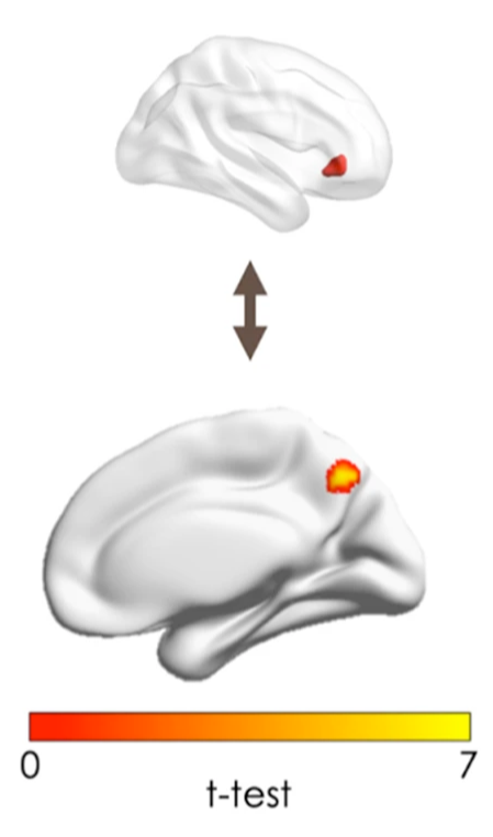 protobrain